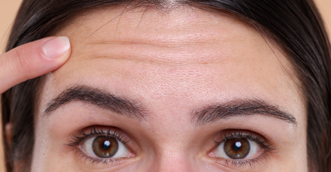 Reduce Fine Lines and Prevent Wrinkles