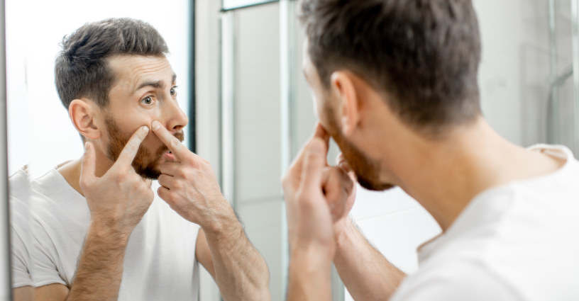 Warum das Ausdrcken von Pickeln schlecht ist MaGeAu Naturel Warum das Ausdrcken von Pickeln schlecht ist MaGeAu Naturel