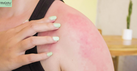 Sensitive Skin vs. Allergic Reactions