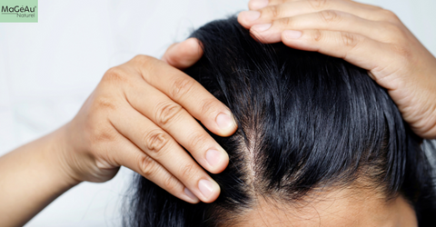 Myth Busted: Why Does Your Scalp Need Special Care? Natural Hair Care Products That Help