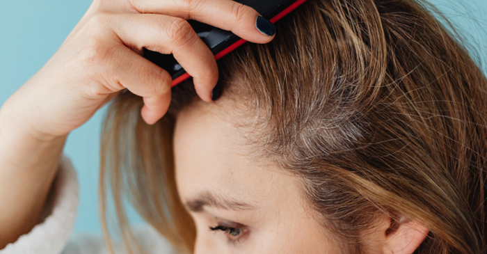 Itchy Scalp