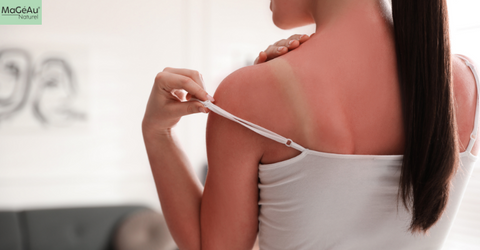 Sensitive Skin Solution: Why Magnesium Is a Trusted Choice by Pharmacists
