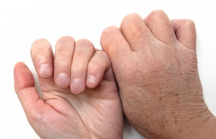 Understanding the Causes of Cracked Hands | Detailed Analysis