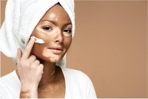 How to choose the best moisturiser for oily skin?