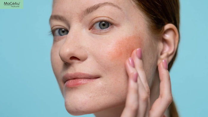 Urban Skin Stress 101: What Pollution Actually Does to Reactive Skin